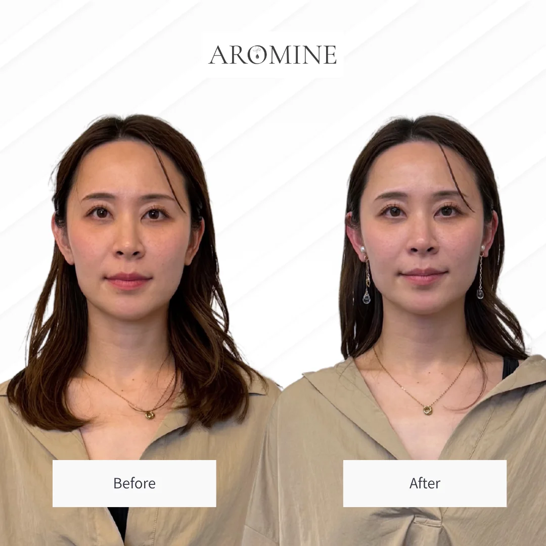 AROMINE 制作クラスのBefore / After事例 1