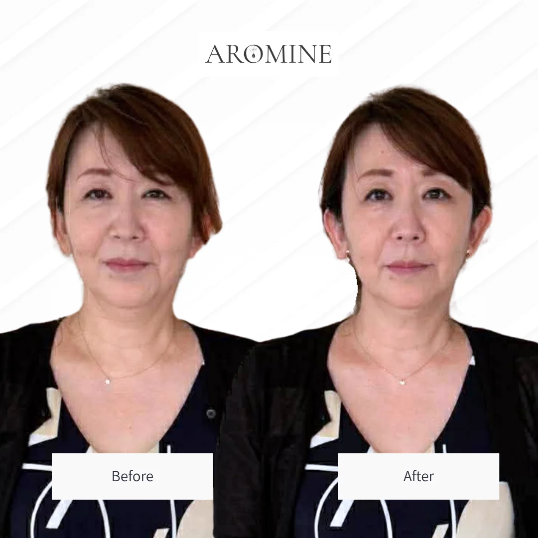 AROMINE 制作クラスのBefore / After事例 2