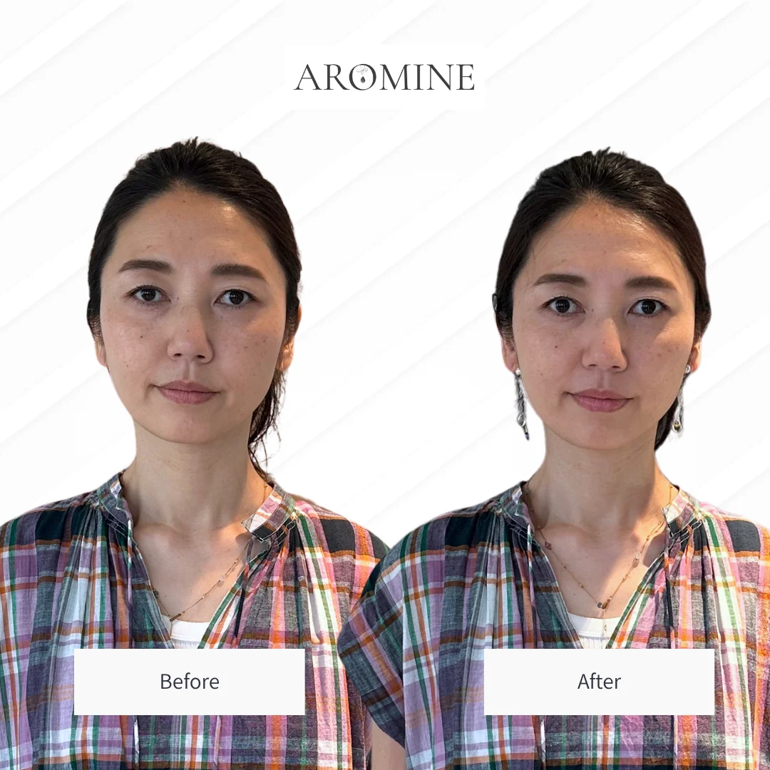 AROMINE 制作クラスのBefore / After事例 3